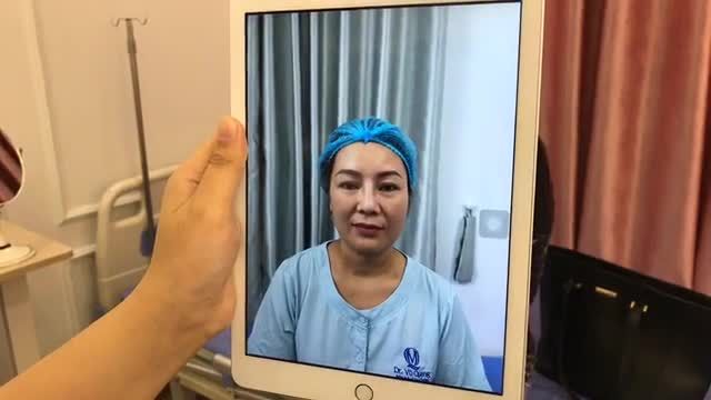 Tiếp tục gặp gỡ 1 cô khách hàng đã tham dự trong NGÀY HỘI PHẪU THUẬT THẨM MỸ 2019 vừa qua và may mắn nhận được phần quà 1 CHỈ VÀNG khi thực hiện NÂNG MŨI tại Dr Vũ Quang.