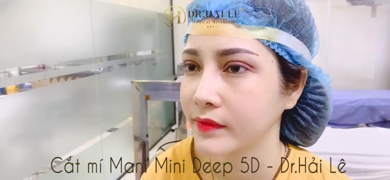 MỘT MÍ - HAI MÍ BẠN CHỌN VẺ ĐẸP NÀO?