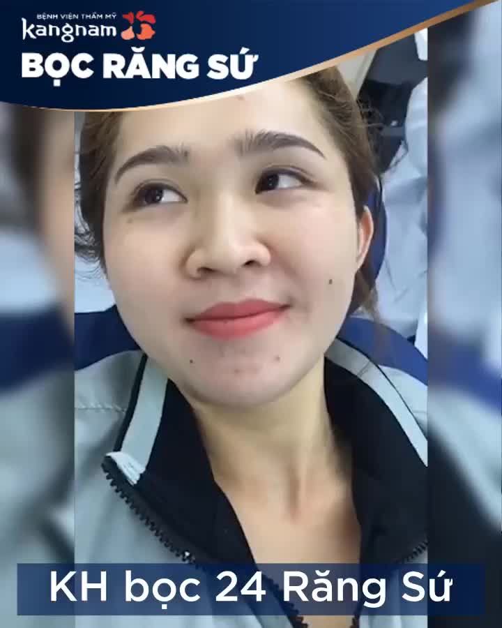 Trải nghiệm Bọc 24 Răng Sứ của khách hàng Kangnam