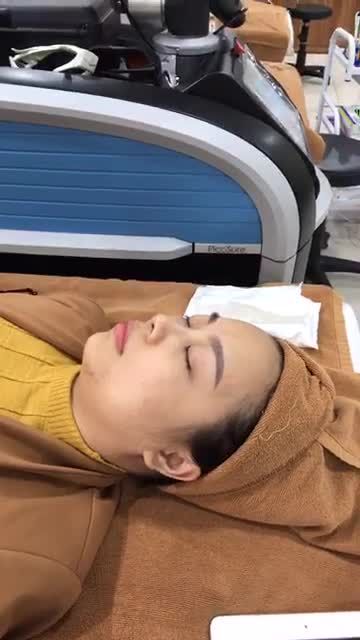 Trị nám, tàn nhang cho chị Hồng đến từ Hà Nội