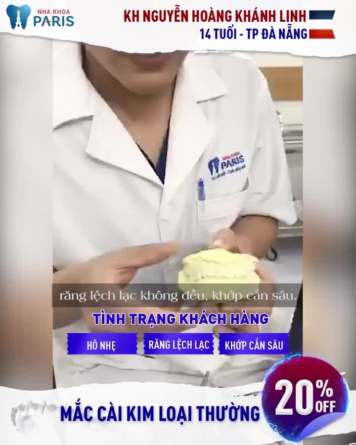 NIỀNG RĂNG ĐIỀU TRỊ KHỚP CẮN SÂU, NGĂN NGỪA BỆNH LÝ CÙNG CHUYÊN GIA