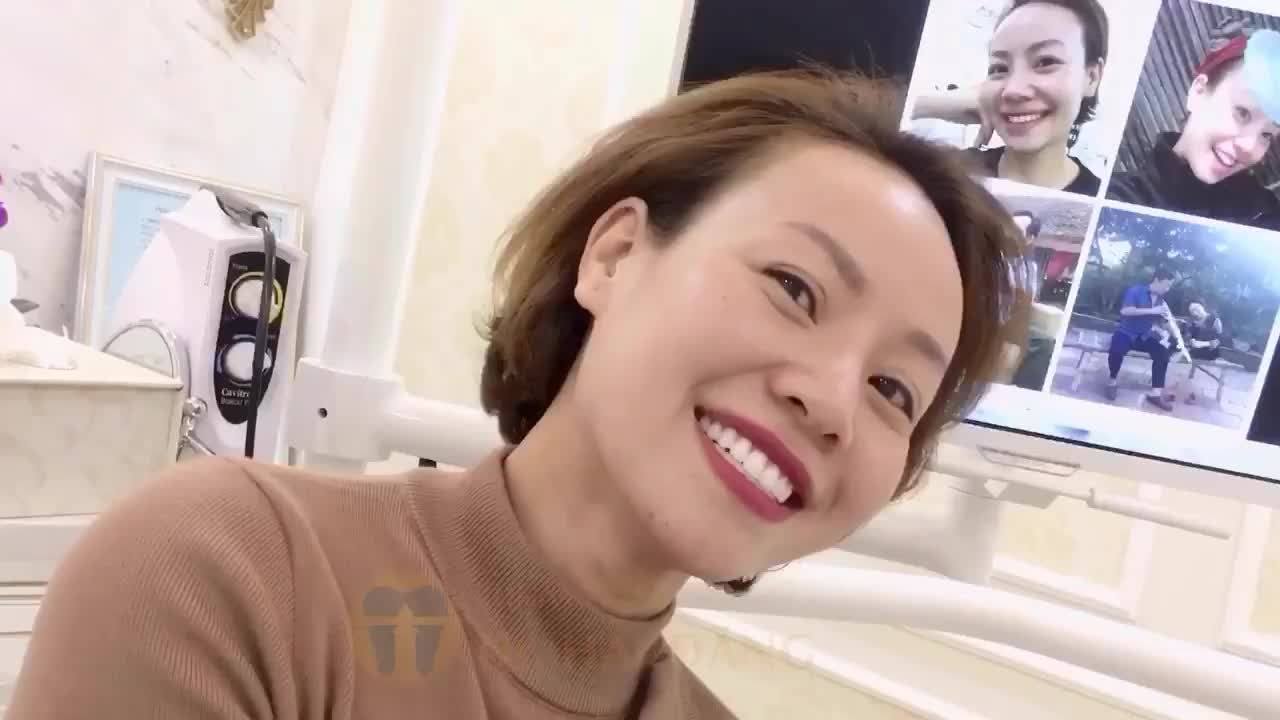 ĐỂ MỊ NÓI CHO MÀ NGHE DÁN SỨ VENEER KHÔNG MÀI HOẶC MÀI ÍT LÀ CÓ THẬT.