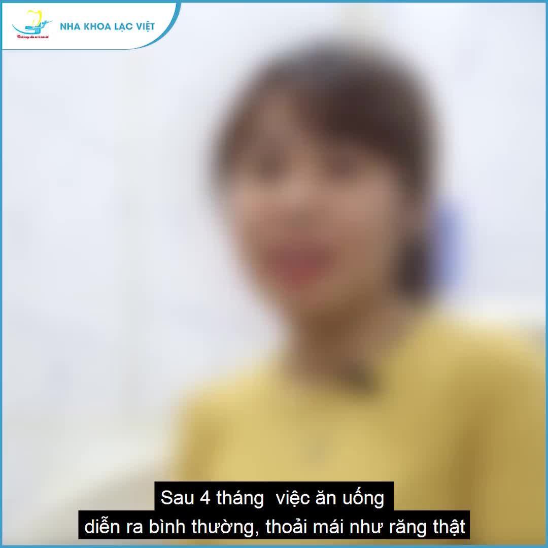 "Sau 4 tháng trồng răng implant tại Lạc Việt, chị ăn nhai thoải mái NHƯ RĂNG THẬT, không hề có cảm giác răng giả.."
