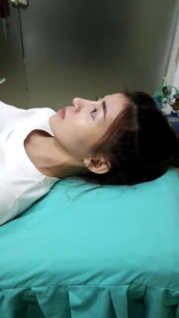 Tái khám dịch vụ Nâng mũi cấu trúc bọc cân thái dương sửa lại sau thời gian 3 tháng