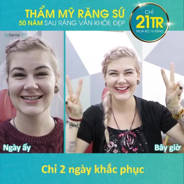 Tạm biệt RĂNG KHẤP KHỂNH, NHIỄM MÀU, HÔ THƯA... kém duyên