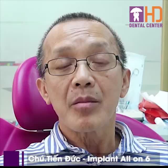 TRỒNG RĂNG IMPLANT Ở VIỆT NAM KHÔNG CHỈ CHẤT LƯỢNG MÀ THỜI GIAN CÒN NHANH!