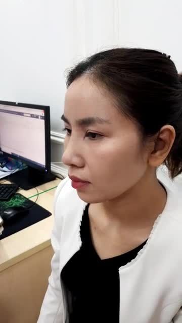 Mũi đẹp toàn diện với Combo: Nâng mũi CẤU TRÚC 4D + Cắt cánh