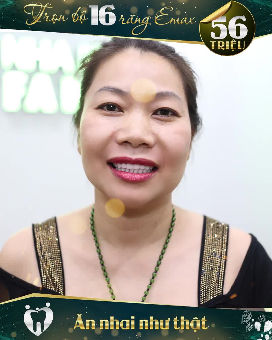 “BIẾT LÀM RĂNG XONG MÀ ĐẸP THẾ NÀY CHỊ ĐÃ ĐI LÀM TỪ LÂU RỒI!”