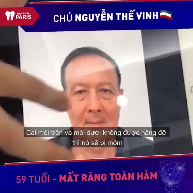 Chú Vinh (TP HCM), mất răng toàn hàm Khôi phục răng mất tức thì sau 7 ngày