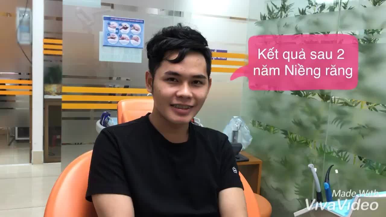 CHỈ NHỜ NIỀNG RĂNG ĐƯỢC BONUS THÊM KHUÔN MẶT ĐIỂN TRAI