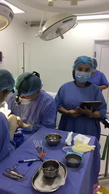 KH cấy thêm 1000 nang tóc tự thân Bio Hairtransplant khu vực đỉnh đầu