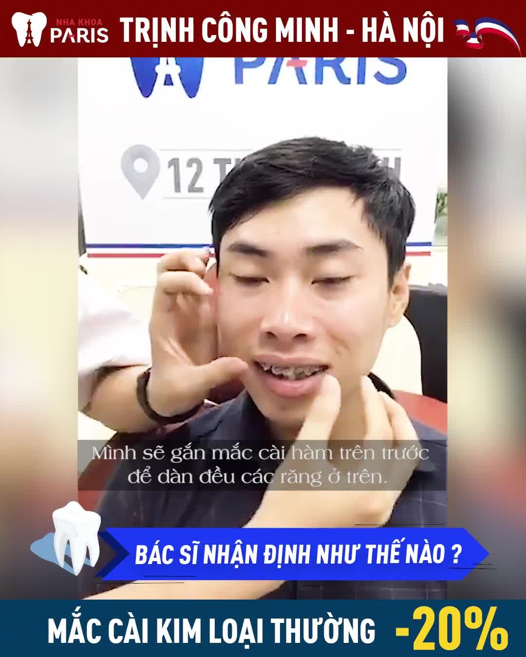 NIỀNG RĂNG ĐIỀU TRỊ RĂNG KHẤP KHỂNH, XÔ LỆCH CÙNG CHUYÊN GIA