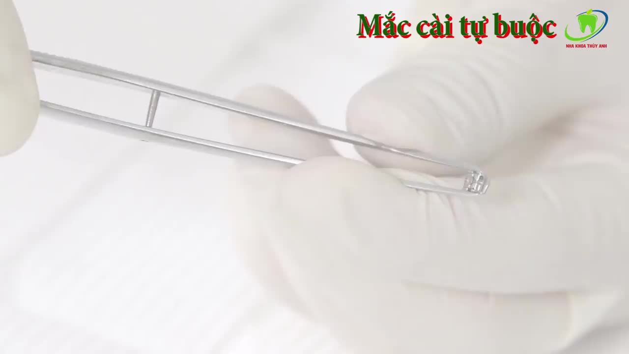 MẮC CÀI TỰ BUỘC THÔNG MINH LÀ GÌ?