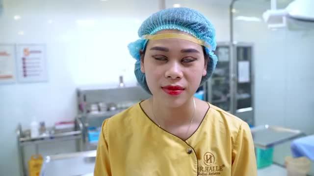 Cùng theo dõi kết quả của vị khách hàng vừa cắt mí Mani Open Deep 5D kết hợp mở góc mắt tại Dr. Hải Lê