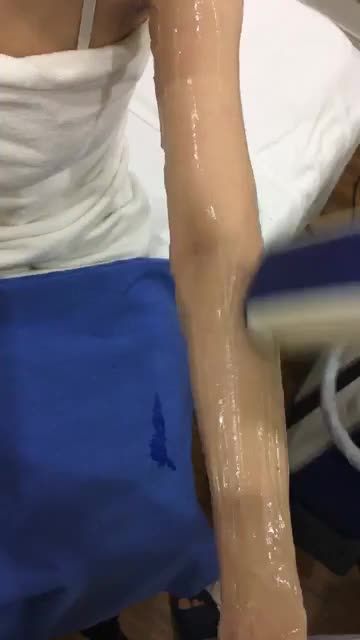 Triệt lông Diode Laser công nghệ Hoa Kỳ - Sạch tới 99% lông mọi phân vùng