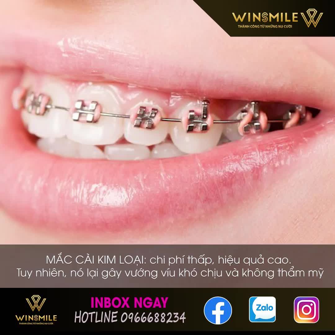 NIỀNG RĂNG - CHỈ CÓ LỢI MÀ KHÔNG HỀ CÓ HẠI