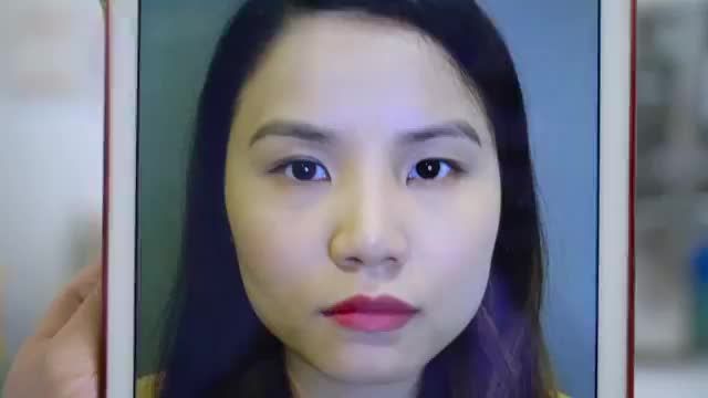 Cận cảnh kết quả cắt mí Mani Open Deep 5D - Siêu phẩm mắt đẹp "nức lòng".