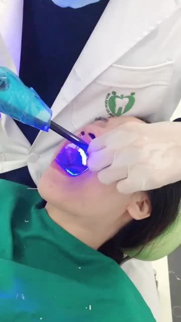 CASE PHỦ 12 VENEER NGỌC TRAI CERAMAY tại chi nhánh Trần Thái Tông