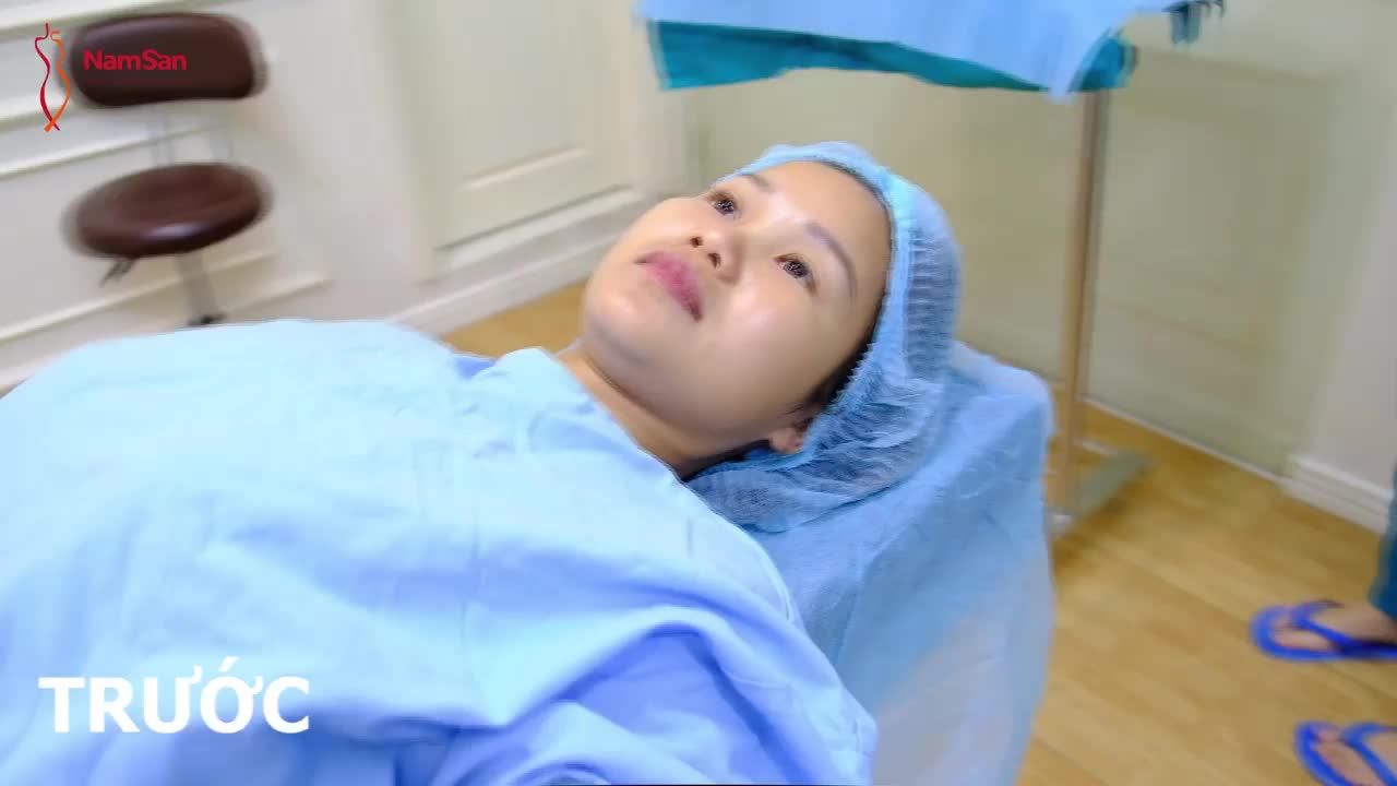 Nâng Mũi Chỉ Đẹp Khi Phân Tích Đúng Hiện Trạng Và Chia Tỷ Lệ Mũi Phù Hợp.
