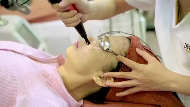 TRỊ NÁM LASER DIAMOND SQUARE - Trở lại 10 năm thanh xuân!