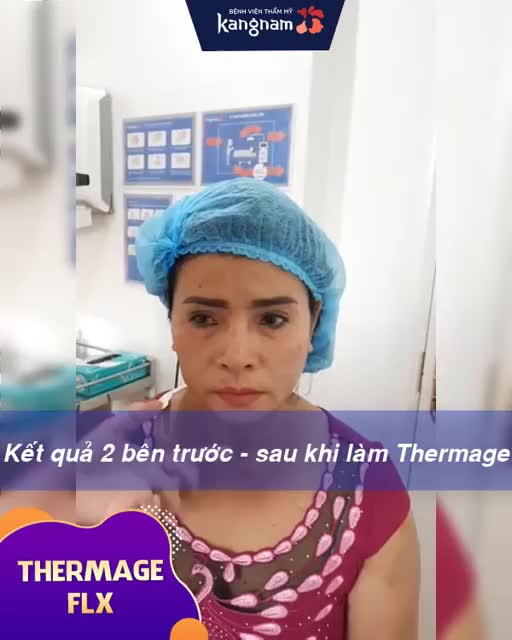 Nâng cơ xóa nhăn chỉ sau 1 giờ - Da săn chắc, căng mịn với THERMAGE FLX