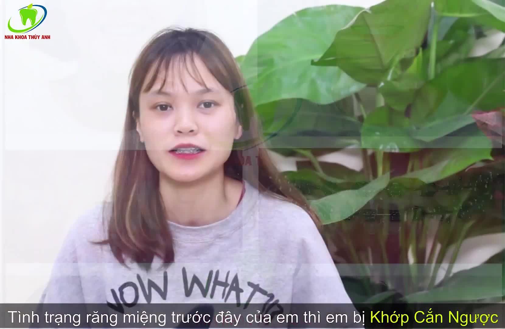 NIỀNG RĂNG HÀNH TRÌNH TÌM LẠI NỤ CƯỜI VỐN CÓ CỦA CHÍNH MÌNH