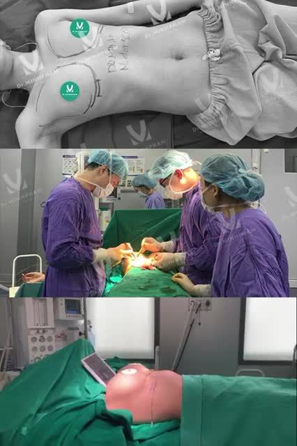 KẾT QUẢ NÓI LÊN TẤT CẢ