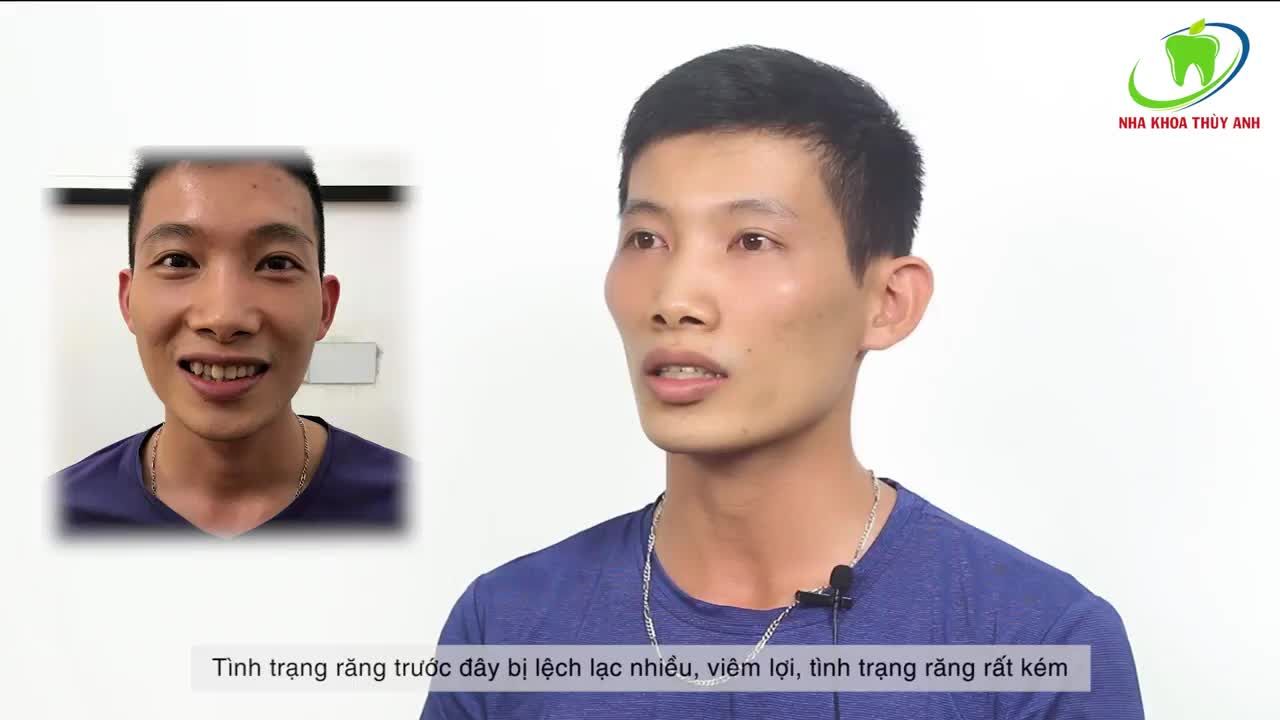 NIỀNG RĂNG LUÔN LÀ SỰ LỰA CHỌN ĐÚNG ĐẮN.