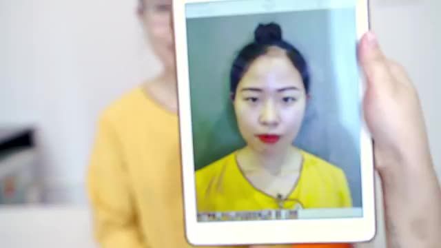 Siêu phẩm cắt mí và mở góc mắt khiến chàng chết mê!