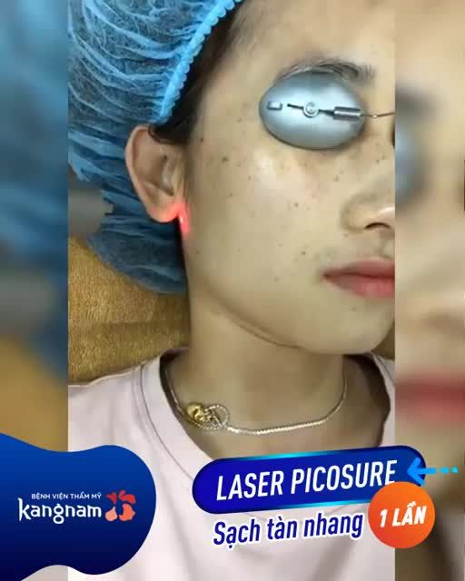 ĐIỀU TRỊ TÀN NHANG - Tặng ưu đãi 30%