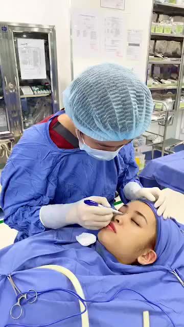 Quy trình phân tích - thiết kế, Đo vẽ trước khi Nâng mũi cấu trúc 4D tại BVTM Kangnam