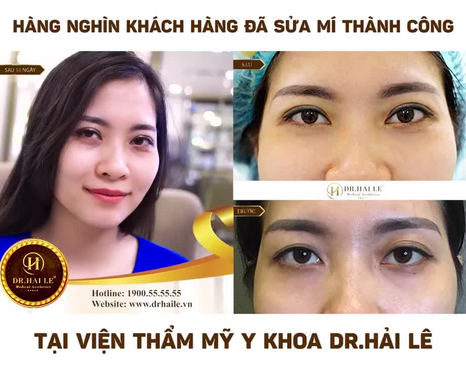 "TÁI SINH" MÍ XẤU HỎNG TẠI VTM DR.HẢI LÊ - ĐẸP VÀ ĐẸP HƠN NỮA!