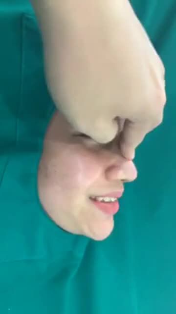 Dáng mũi đẹp chuẩn nhất hiện nay