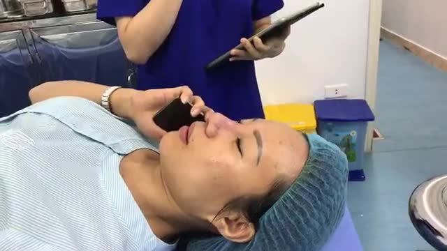Kết quả ca mũi hỏng + biến chứng trực tiếp dr vũ quang thực hiện