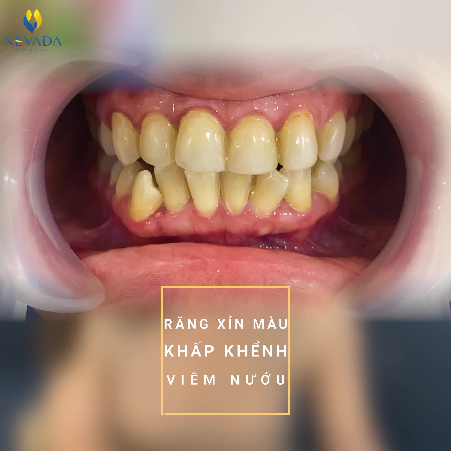 NGƯỜI TA THOẢI MÁI CƯỜI, CÒN BẠN THÌ KHÔNG?
LÝ DO VÌ...