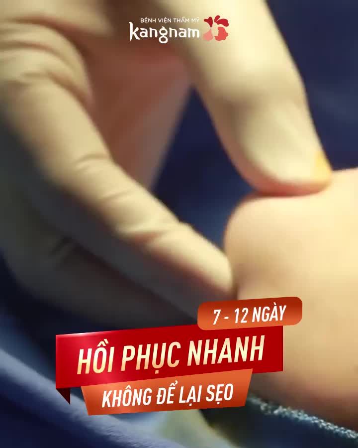 "Tạm biệt" Cằm Ngắn/ Lẹm/ Lệch nhờ ĐỘN CẰM VLINE