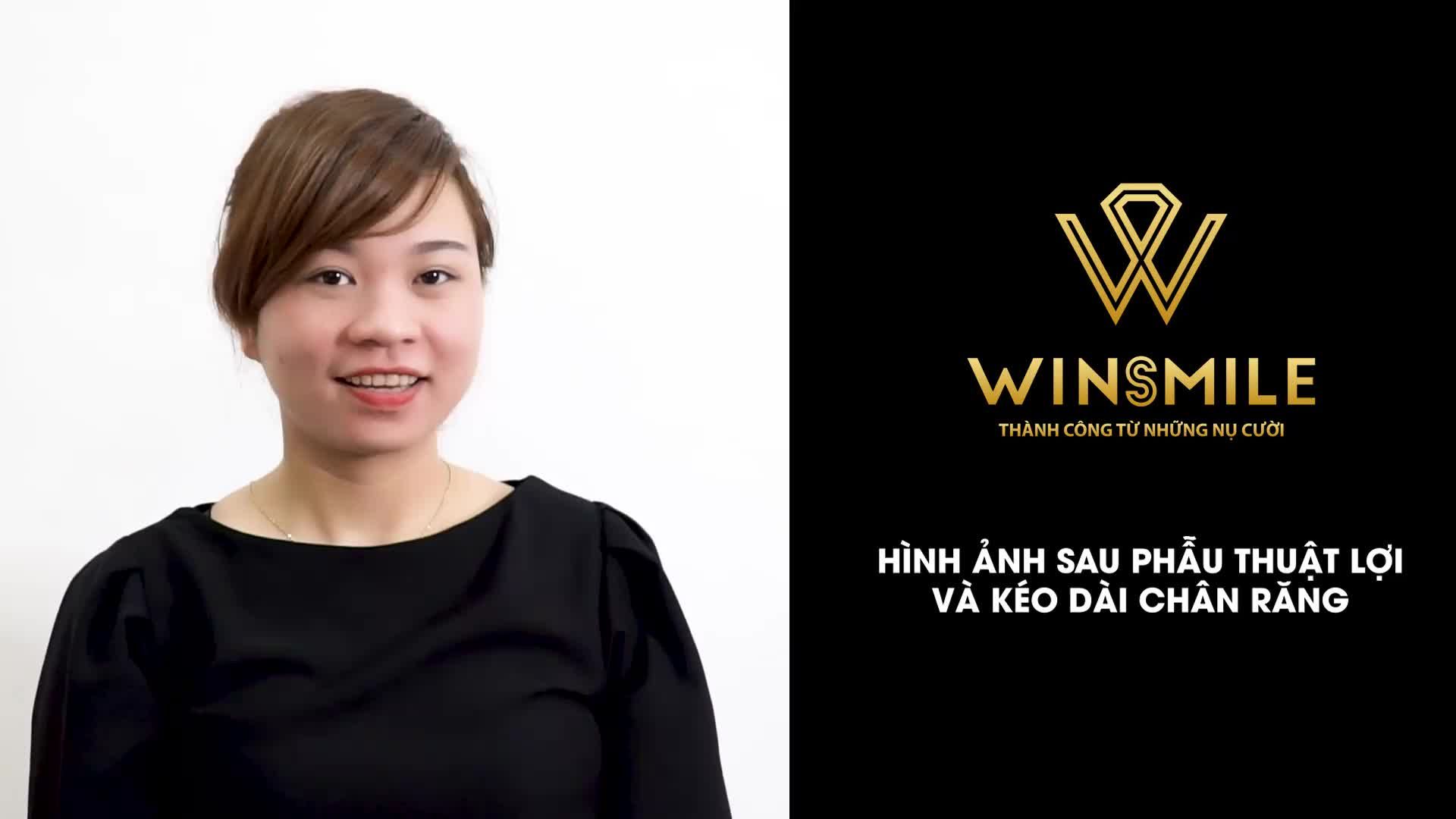 THÀNH CÔNG CỦA WIN SMILE LÀ THAY ĐỔI NỤ CƯỜI CỦA BẠN