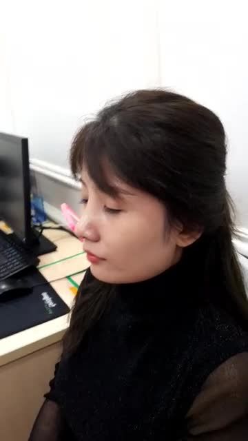Đây là MŨI SAU 1 THÁNG Nâng mũi cấu trúc 4D siêu âm: Đẹp tự nhiên mọi khoảnh khắc!