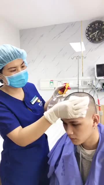 Quá trình Thay băng Tóc , Làm vệ sinh tóc sau Cấy .