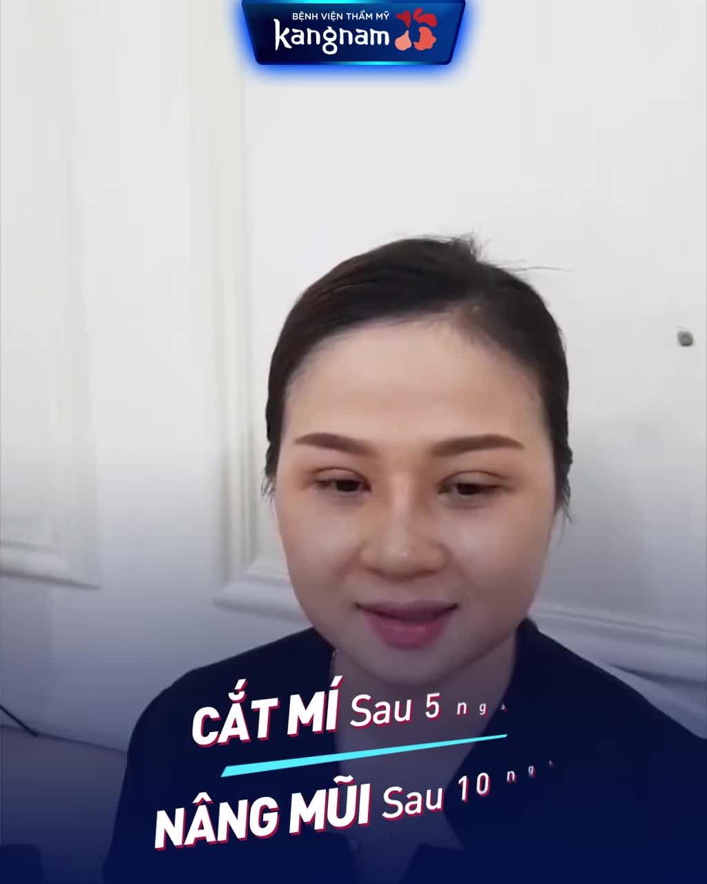 Chỉ Nâng mũi  Cắt mí - "CỨU" cả khuôn mặt
