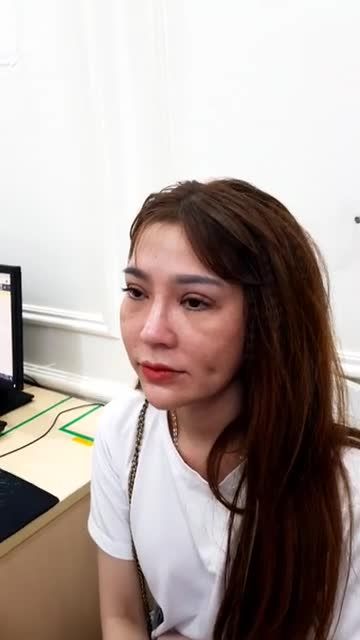 KHÁCH HÀNG THỰC HIỆN COMBO "NÂNG MŨI SLINE 4D, CẮT MÍ TRÊN PLASMA, CẮT MÍ DƯỚI PLASMA, TẠO MÁ LÚM"