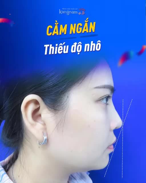 Đẹp ngay sau 30 PHÚT - chỉ có thể là ĐỘN CẰM tại Kangnam