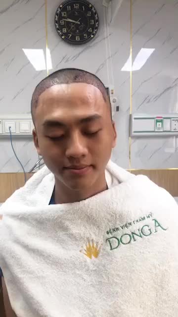 Hướng dẫn làm vệ sinh và thay băng tóc sau khi cấy