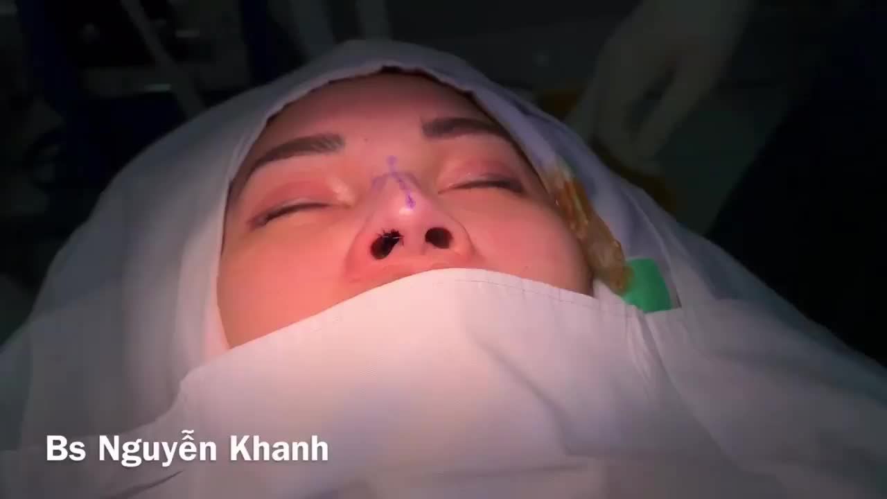 Nếu muốn mũi đẹp hãy tìm BS Khanh, còn muốn hết xoang tìm BS tai mũi họng nhé mọi người.