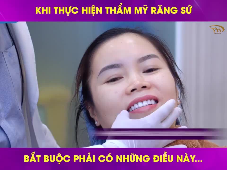 NHỮNG LƯU Ý TRƯỚC KHI QUYẾT ĐỊNH LÀM RĂNG SỨ BẠN CẦN BIẾT