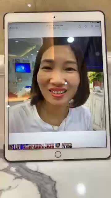 Sự thay đổi sau 6 tháng cắt lợi và hôm nay thay đổi chỉ là 20 răng tạm.