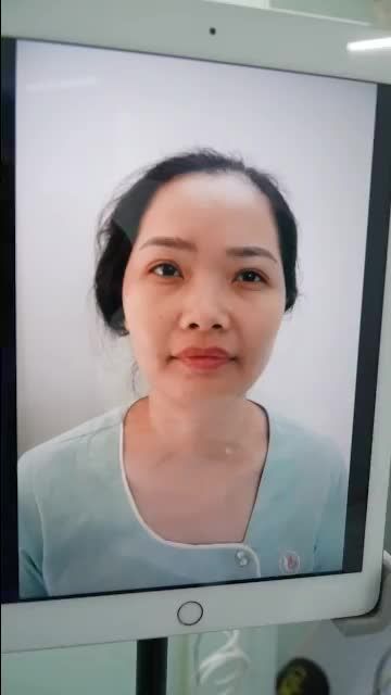TIẾP TỤC CA MŨI CẤU TRÚC VỪA THỰC HIỆN XONG