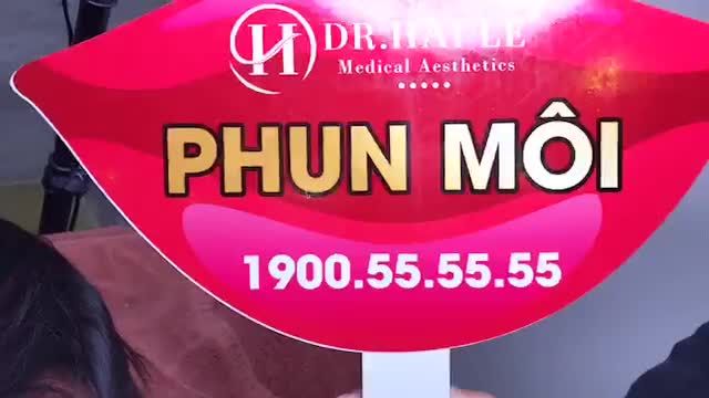 KẾT QUẢ PHUN MÔI COLLAGEN + tạo môi trái tim sau 1 năm.