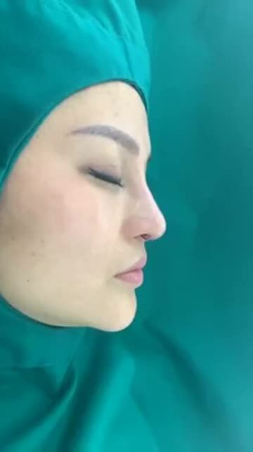 MŨI ĐỂ SỬA ĐI SỬA LẠI THẾ NÀY CÓ GẮT KHÔNG CƠ CHỨ