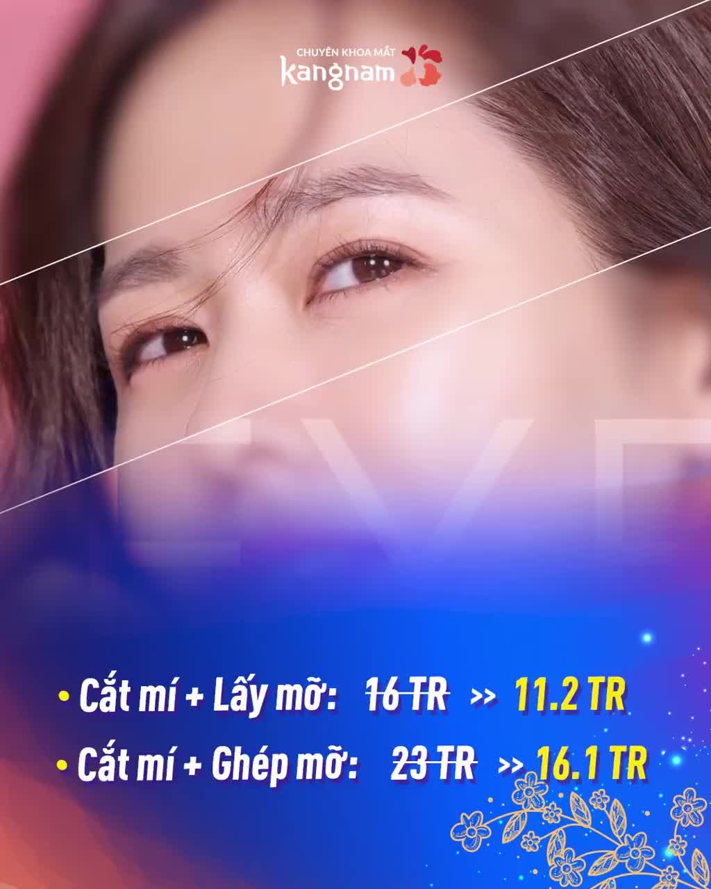 Ưu Đãi TẾT  Cắt Mí GIÁ TỐT NHẤT NĂM